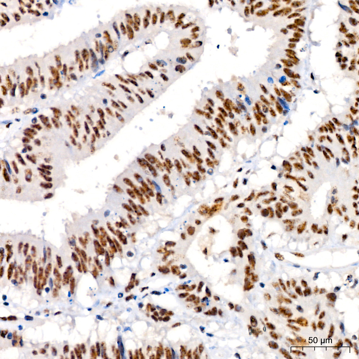 Phospho-JNK1/2/3-T183/T183/T221 Rabbit Monoclonal Antibody - Image 2