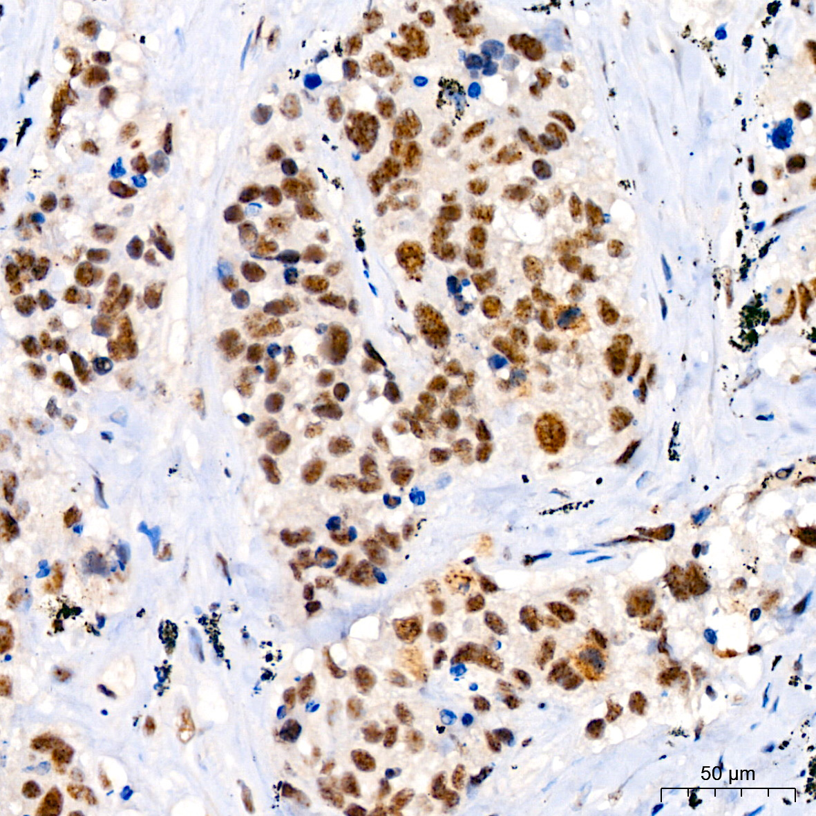 Phospho-JNK1/2/3-T183/T183/T221 Rabbit Monoclonal Antibody - Image 4