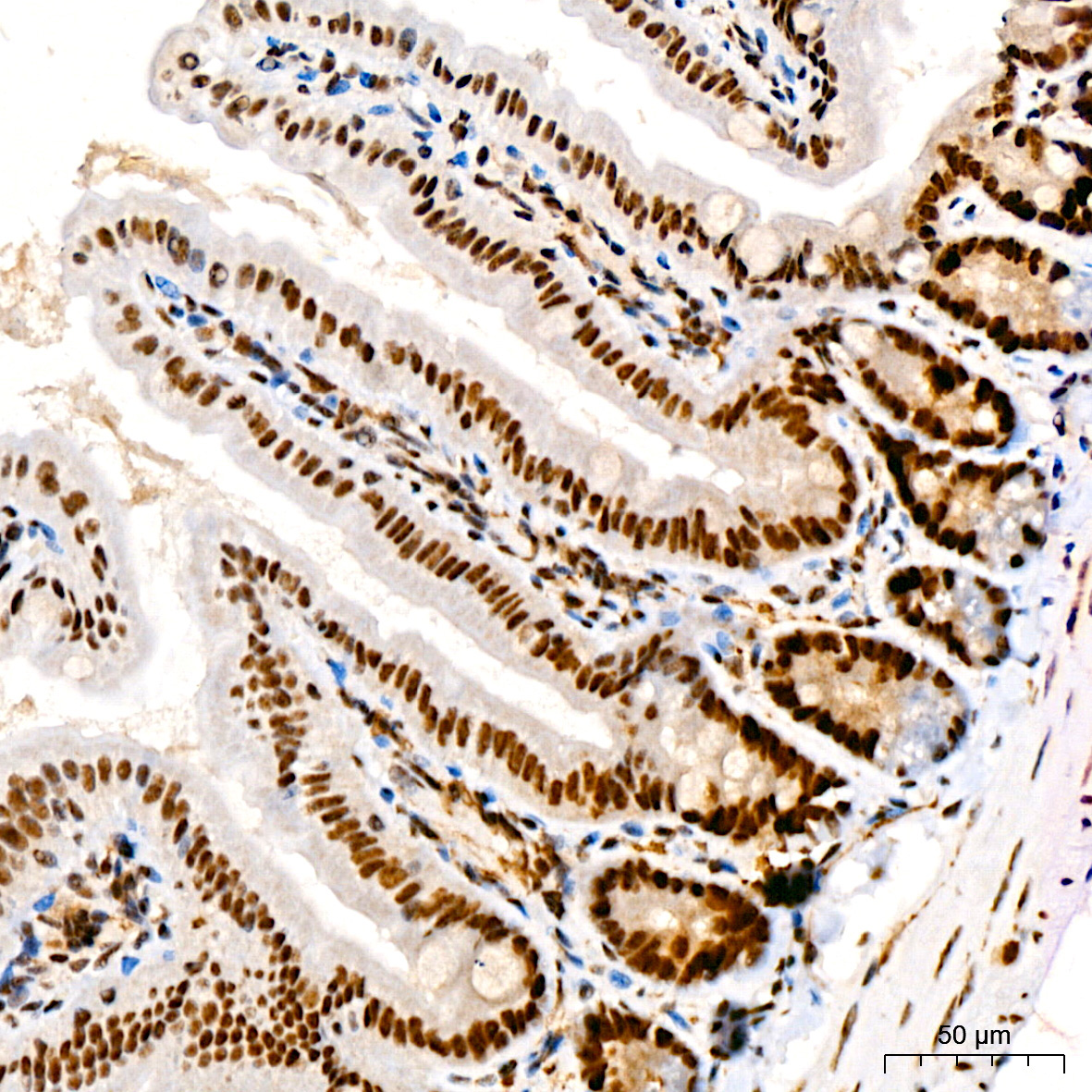 Phospho-JNK1/2/3-T183/T183/T221 Rabbit Monoclonal Antibody - Image 6