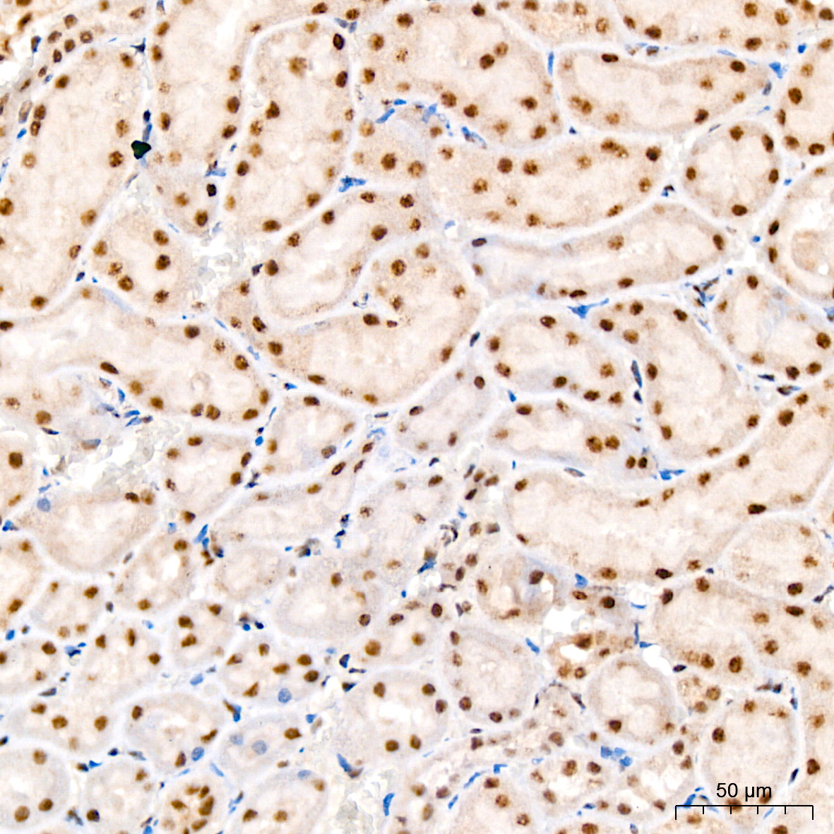Phospho-JNK1/2/3-T183/T183/T221 Rabbit Monoclonal Antibody - Image 7
