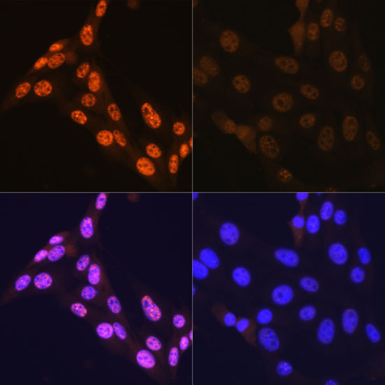 Phospho-JNK1/2/3-T183/T183/T221 Rabbit Monoclonal Antibody - Image 9