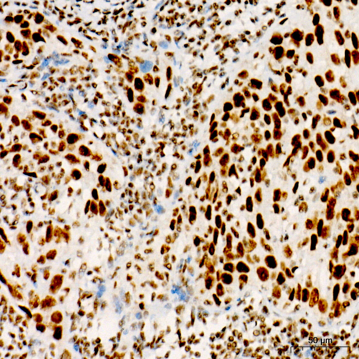 Phospho-JunD-S255 Rabbit Monoclonal Antibody - Image 2