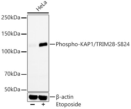 Phospho-KAP1/TRIM28-S824 Rabbit Monoclonal Antibody