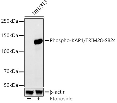 Phospho-KAP1/TRIM28-S824 Rabbit Monoclonal Antibody - Image 2