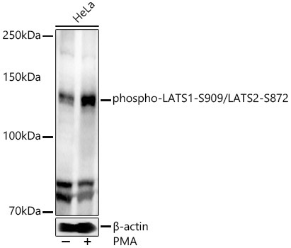 phospho-LATS1-S909/LATS2-S872 Rabbit Polyclonal Antibody