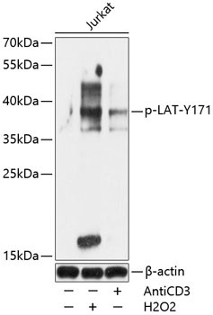 Phospho-LAT-Y171 Rabbit Polyclonal Antibody