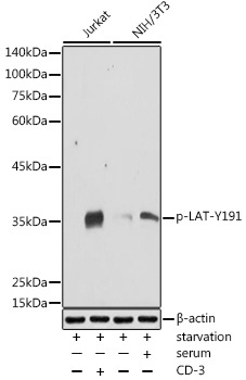Phospho-LAT-Y191 Rabbit Polyclonal Antibody