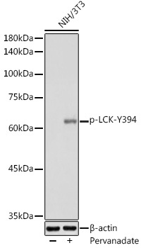 Phospho-LCK-Y394 Rabbit Polyclonal Antibody