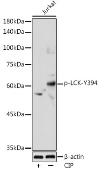 Phospho-LCK-Y394 Rabbit Polyclonal Antibody - Image 2