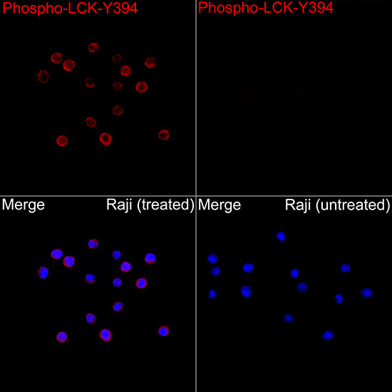 Phospho-LCK-Y394 Rabbit Polyclonal Antibody - Image 3