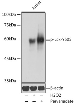 Phospho-Lck-Y505 Rabbit Polyclonal Antibody
