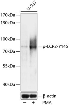 Phospho-LCP2-Y145 Rabbit Polyclonal Antibody