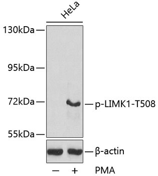 Phospho-LIMK1-T508 Rabbit Polyclonal Antibody