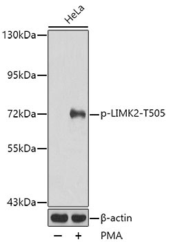 Phospho-LIMK2-T505 Rabbit Polyclonal Antibody