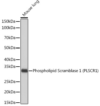 Phospholipid Scramblase 1 (PLSCR1) Rabbit Monoclonal Antibody - Image 2