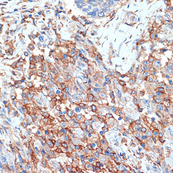 Phospholipid Scramblase 1 (PLSCR1) Rabbit Monoclonal Antibody - Image 3