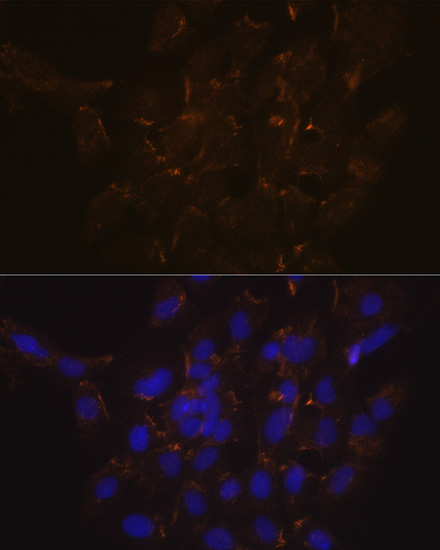 Phospholipid Scramblase 1 (PLSCR1) Rabbit Monoclonal Antibody - Image 4