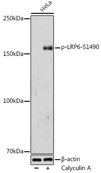 Phospho-LRP6-S1490 Rabbit Polyclonal Antibody