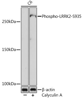 Phospho-LRRK2-S935 Rabbit Monoclonal Antibody - Image 2
