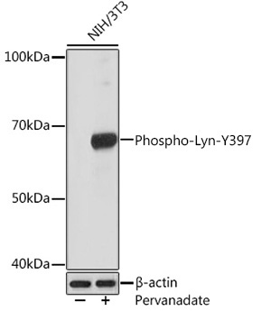 Phospho-Lyn-Y396 Rabbit Monoclonal Antibody
