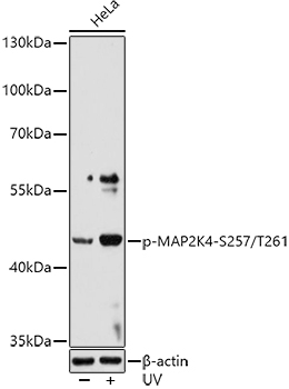 Phospho-MAP2K4-S257/T261 Rabbit Polyclonal Antibody