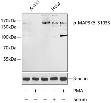 Phospho-MAP3K5-S1033 Rabbit Polyclonal Antibody