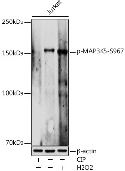 Phospho-MAP3K5-S967 Rabbit Polyclonal Antibody