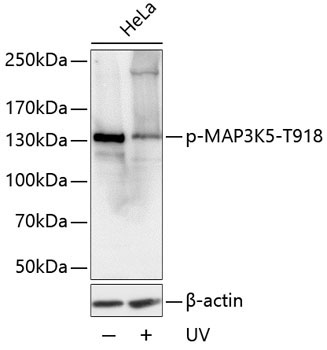 Phospho-MAP3K5-T918 Rabbit Polyclonal Antibody