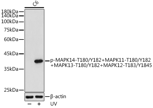 Phospho-MAPK14-T180/Y182+MAPK11-T180/Y182+MAPK13-T180/Y182+MAPK12-T183/Y1845 Rabbit Polyclonal Antibody