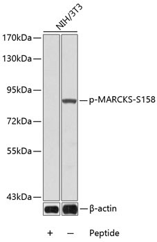 Phospho-MARCKS-S158 Rabbit Polyclonal Antibody