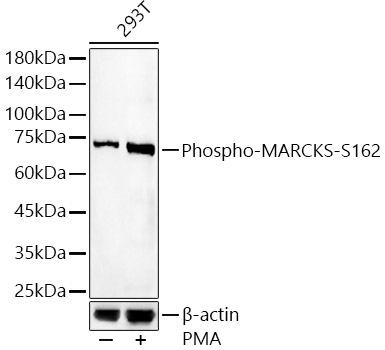 Phospho-MARCKS-S162 Rabbit Polyclonal Antibody