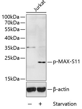 Phospho-MAX-S11 Rabbit Polyclonal Antibody