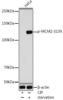 Phospho-MCM2-S139 Rabbit Polyclonal Antibody