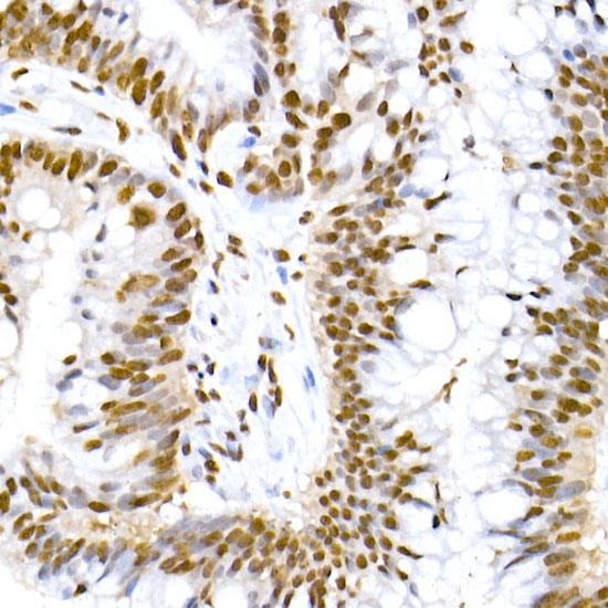 Phospho-MDM2-S166 Rabbit Monoclonal Antibody