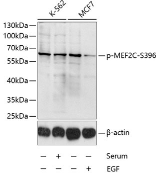 Phospho-MEF2C-S396 Rabbit Polyclonal Antibody