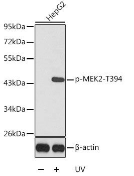 Phospho-MEK2-T394 Rabbit Polyclonal Antibody