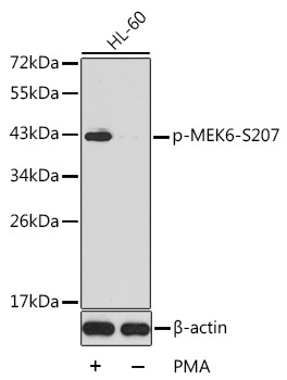 Phospho-MEK6-S207 Rabbit Polyclonal Antibody