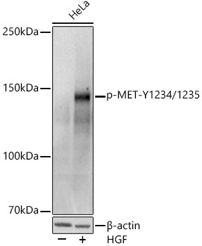 Phospho-MET-Y1234/1235 Rabbit Polyclonal Antibody
