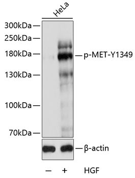 Phospho-MET-Y1349 Rabbit Polyclonal Antibody