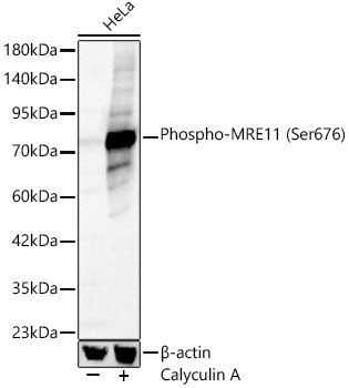 Phospho-MRE11 (Ser676) Rabbit Polyclonal Antibody