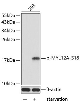 Phospho-MYL12A-S18 Rabbit Polyclonal Antibody