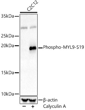 Phospho-MYL9-S19 Rabbit Polyclonal Antibody