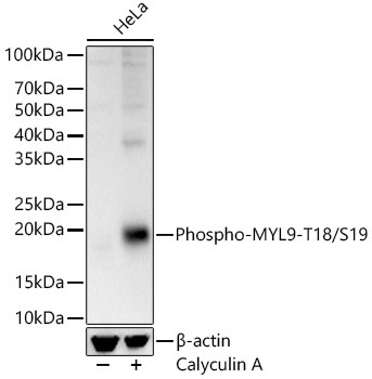Phospho-MYL9-T18/S19 Rabbit Polyclonal Antibody