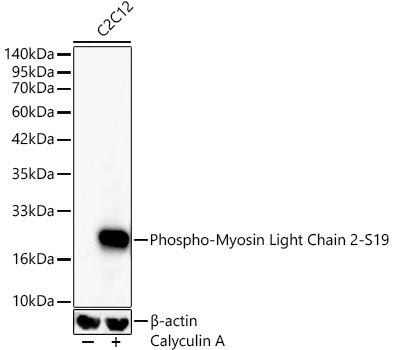 Phospho-Myosin Light Chain 2-S19 Rabbit Monoclonal Antibody - Image 2