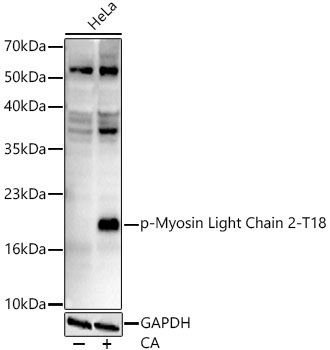 Phospho-Myosin Light Chain 2-T18 Rabbit Monoclonal Antibody
