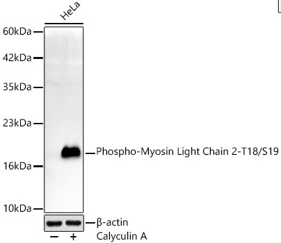 Phospho-Myosin Light Chain 2-T18/S19 Rabbit Monoclonal Antibody