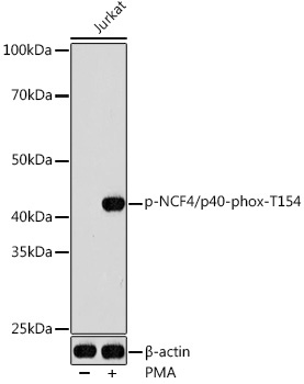 Phospho-NCF4/p40-phox-T154 Rabbit Polyclonal Antibody