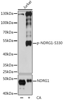 Phospho-NDRG1-S330 Rabbit Polyclonal Antibody
