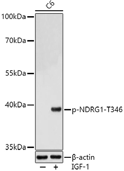 Phospho-NDRG1-T346 Rabbit Polyclonal Antibody