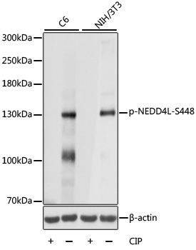 Phospho-NEDD4L-S448 Rabbit Polyclonal Antibody